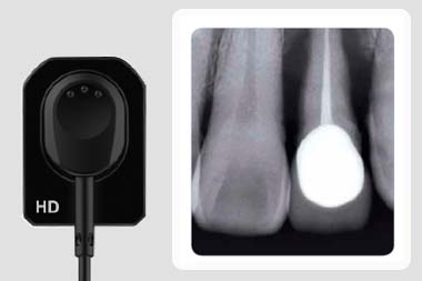 Качество изображений EzSensor HD